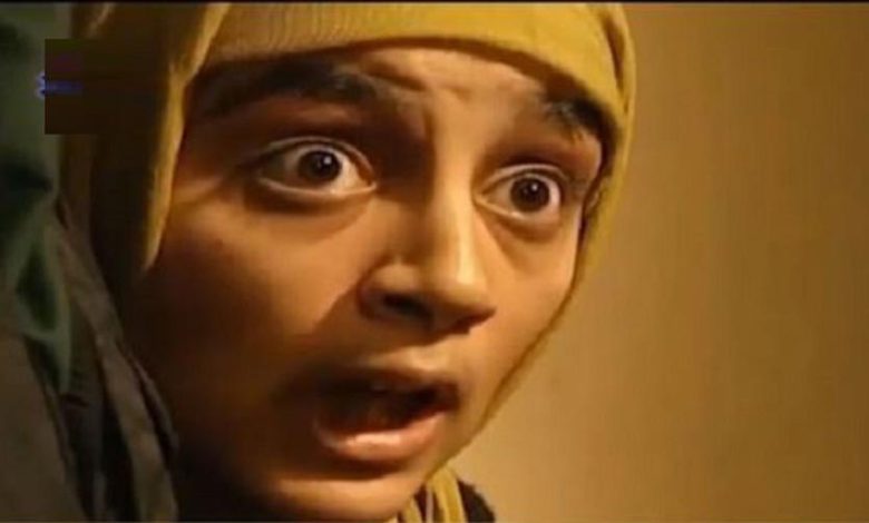 نگاه روز |تغییر چهره خیلی شدید کبری در اصغر کپک را ببینید / قطعا شوکه میشوید نگاه روز |تغییر چهره خیلی شدید کبری در اصغر کپک را ببینید / قطعا شوکه میشوید