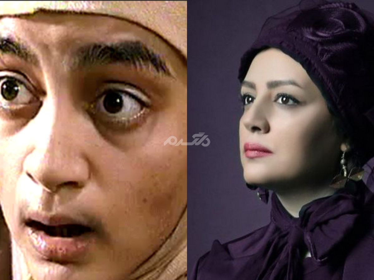 نگاه روز |تغییر چهره خیلی شدید کبری در اصغر کپک را ببینید / قطعا شوکه میشوید