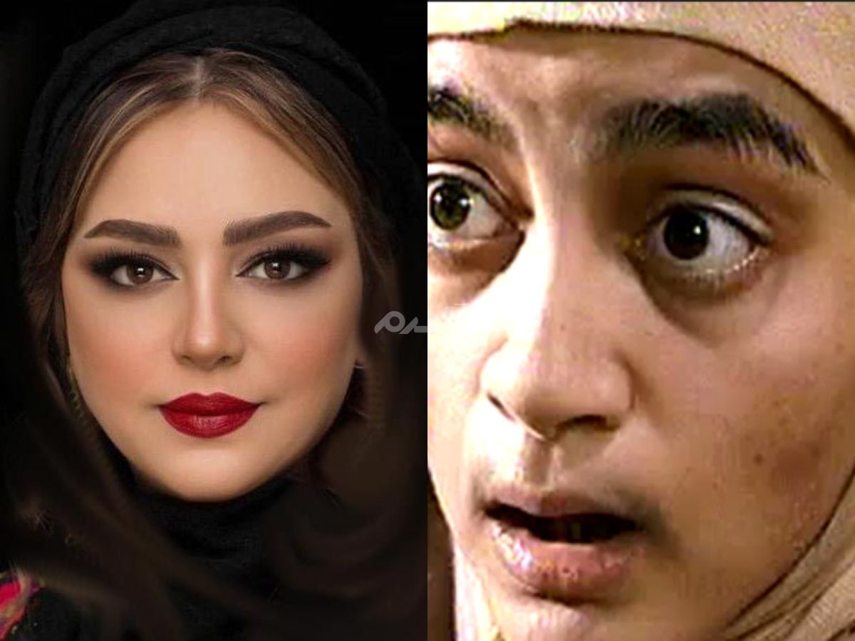 نگاه روز |تغییر چهره خیلی شدید کبری در اصغر کپک را ببینید / قطعا شوکه میشوید نگاه روز |تغییر چهره خیلی شدید کبری در اصغر کپک را ببینید / قطعا شوکه میشوید