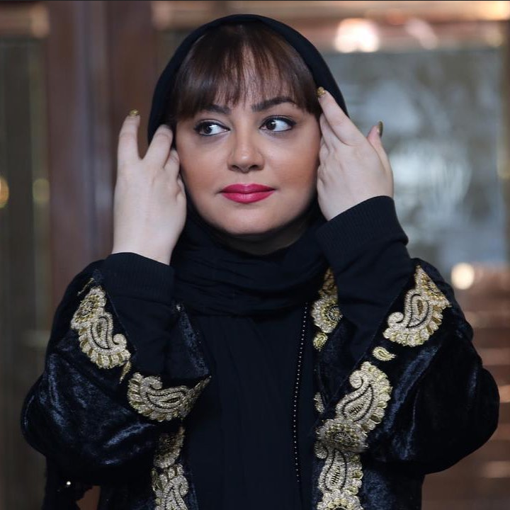 نگاه روز |تغییر چهره خیلی شدید کبری در اصغر کپک را ببینید / قطعا شوکه میشوید