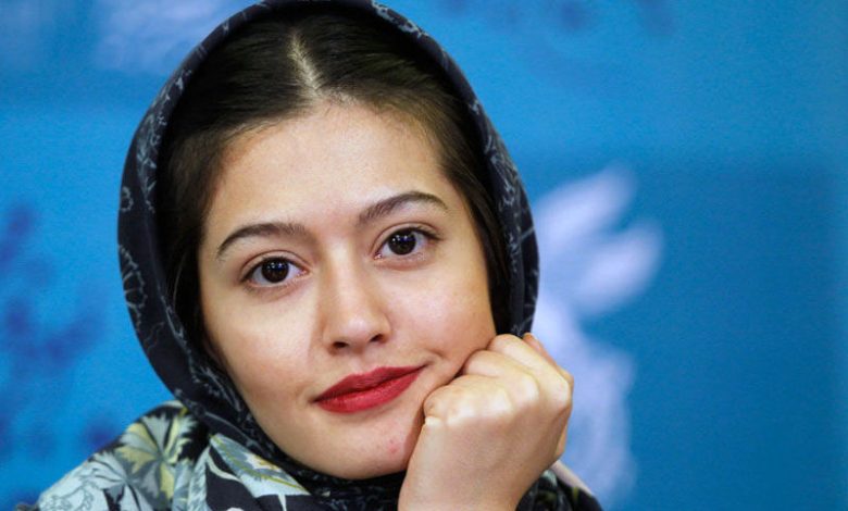 نگاه روز |چهره شوکه کننده از چهره تغییر یافته «پردیس احمدیه»»