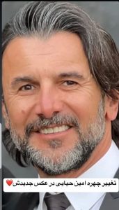 نگاه روز |امین حیایی از چهره جدیدش رونمایی کرد نگاه روز |امین حیایی از چهره جدیدش رونمایی کرد