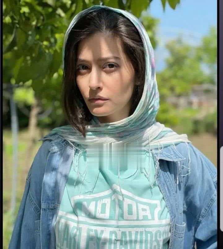 نگاه روز |چهره شوکه کننده از چهره تغییر یافته «پردیس احمدیه»»