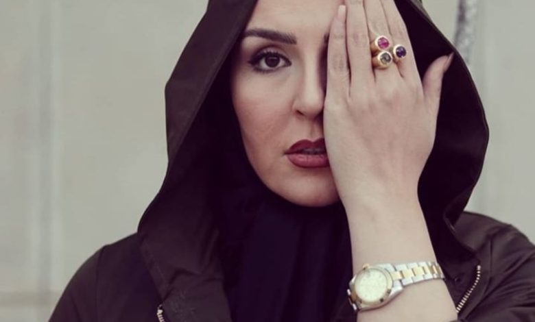 نگاه روز | تغییر چهره آزیتا ترکاشوند در بهترین روز زندگیش نگاه روز | تغییر چهره آزیتا ترکاشوند در بهترین روز زندگیش