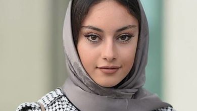 عکس داغ امروز | تصویری شوکه کننده از تغییر چهره ترلان پروانه بازیگر سریال هوش سیاه