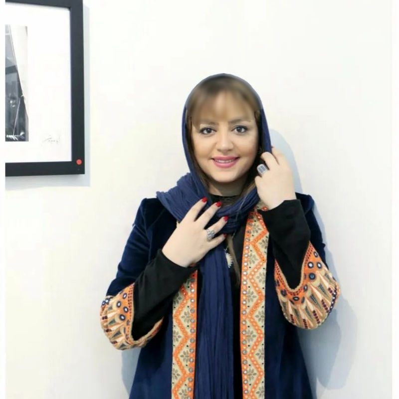 نگاه روز |زیبایی کبری سریال خواب و بیدار در واقعیت