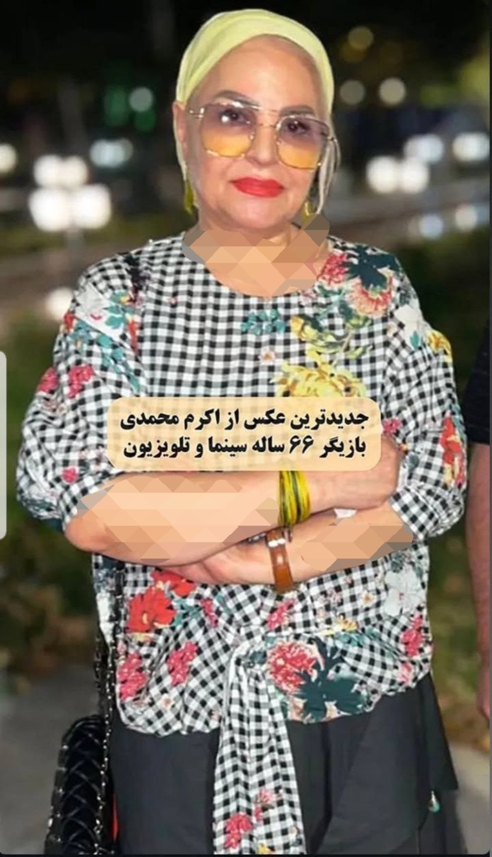 نگاه روز |تغییر چهره اساسی اکرم محمدی در سن ۶۶سالگی