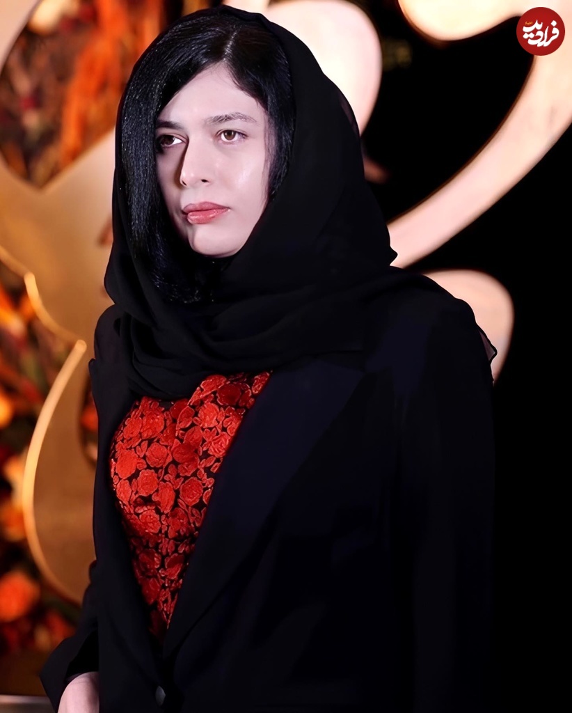 resaneye_omid_1732478081_3508602907704440478_3948875952 resaneye_omid_1732478081_3508602907704440478_3948875952