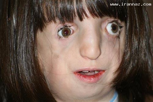 دختری زشت ولی با استعدادی شگفت انگیز! +تصاویر دختری زشت ولی با استعدادی شگفت انگیز! +تصاویر