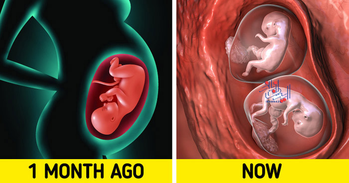 170220547320325-irannaz-com حاملگی مضاعف ، حقایق شگفت انگیز و جالب درمورد دنیای اطراف