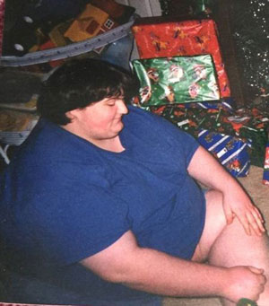 نگاه روز | کاهش وزن 230 کیلویی این مرد زبانزد همه شد + عکس