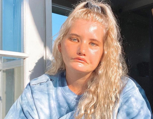 168372382267410-irannaz-com شرکت مدلینک افراد ناتوان و افرادی که تفاوتهایی با دیگران دارند