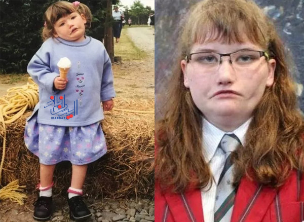 168377842079500-irannaz-com تایلا - Tayla دختری که نمی توانست بخندد، سوپر مدل شد