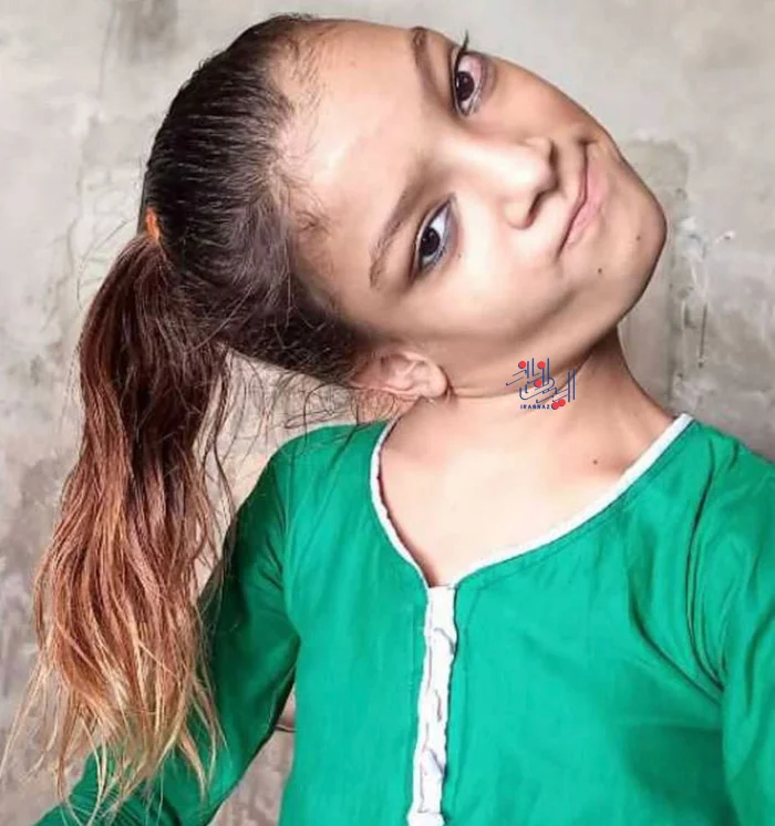 173235285830647-irannaz-com دختری عجیب و ترسناک که گردنش 90 درجه چرخیده!!