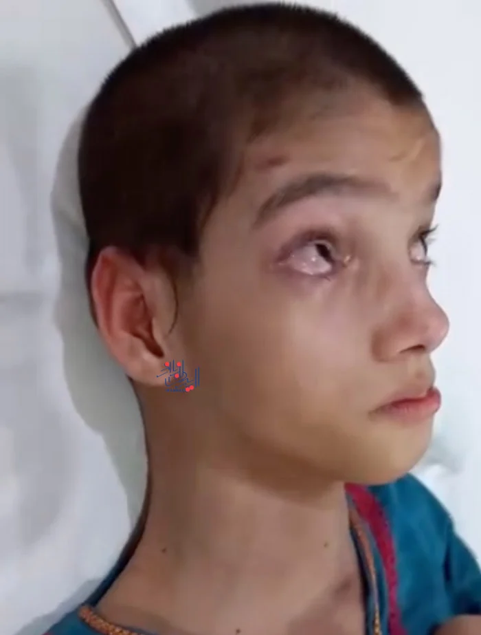 173235286219274-irannaz-com دختری عجیب و ترسناک که گردنش 90 درجه چرخیده!!