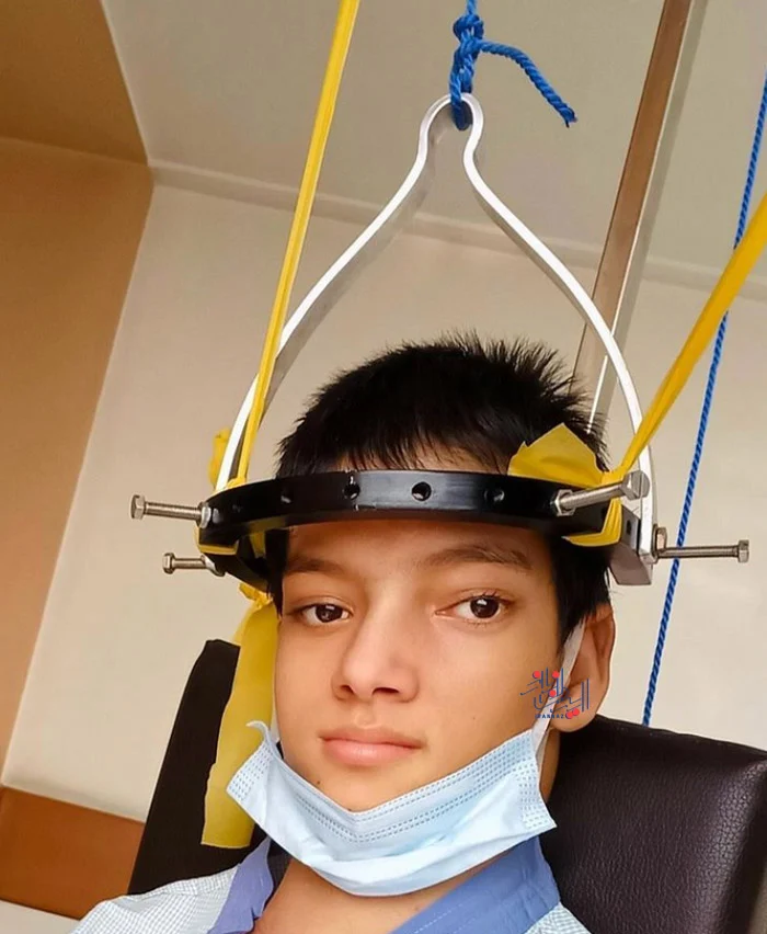 173235290284505-irannaz-com درمان افشین گل (Afsheen Gul) دختر 13 ساله از پاکستان