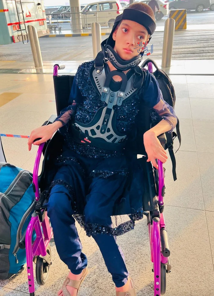 173235291173758-irannaz-com دختری عجیب و ترسناک که گردنش 90 درجه چرخیده!!