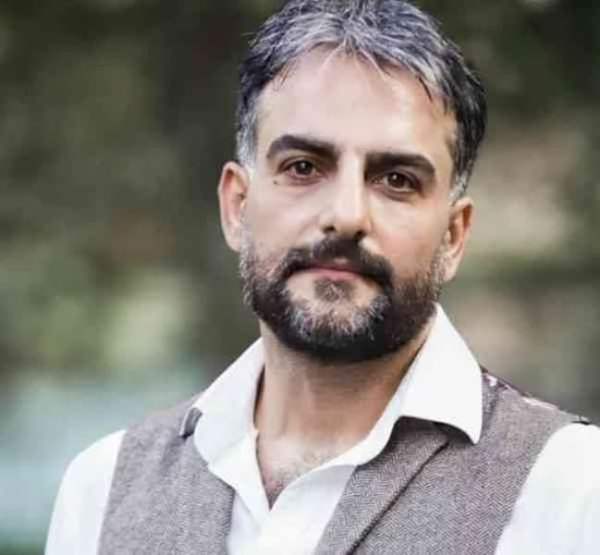 تغییر چهره حامد کمیلی