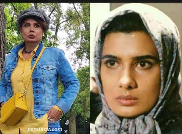 عاطفه رضوی قبل و بعد عمل