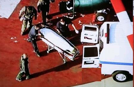 تاریخ و زمان وبگردی؛ مرگ ملکه زیبایی و مدل مشهور بر اثر جراحی زیبایی! تاریخ و زمان وبگردی؛ مرگ ملکه زیبایی و مدل مشهور بر اثر جراحی زیبایی!