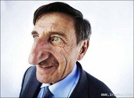 مردی با بزرگ ترین و خنده دار ترین بینی جهان +عکس مردی با بزرگ ترین و خنده دار ترین بینی جهان +عکس