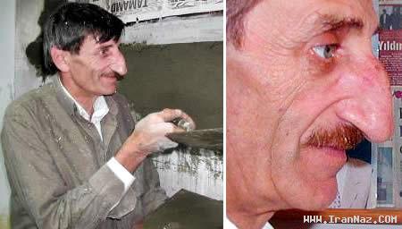 مردی با بزرگ ترین و خنده دار ترین بینی جهان +عکس مردی با بزرگ ترین و خنده دار ترین بینی جهان +عکس