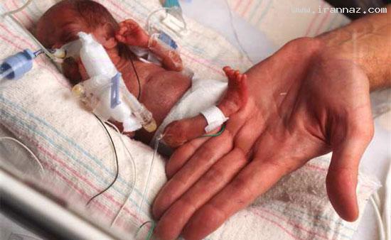 تاریخ و زمان وبگردی؛ تولد کوچکترین نوزاد جهان فقط با 340 گرم وزن +عکس تاریخ و زمان وبگردی؛ تولد کوچکترین نوزاد جهان فقط با 340 گرم وزن +عکس