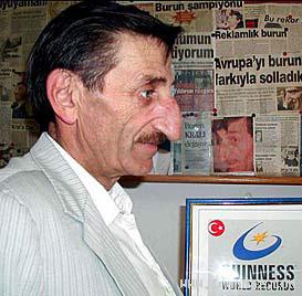 مردی با بزرگ ترین و خنده دار ترین بینی جهان +عکس مردی با بزرگ ترین و خنده دار ترین بینی جهان +عکس