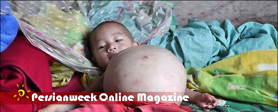 دختر یکساله ای که ۹ ماهه باردار است (+عکس) دختر یکساله ای که ۹ ماهه باردار است (+عکس)