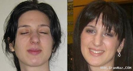 این خانم هر 3 روز، یکبار چشمانش باز میشود +تصاویر این خانم هر 3 روز، یکبار چشمانش باز میشود +تصاویر