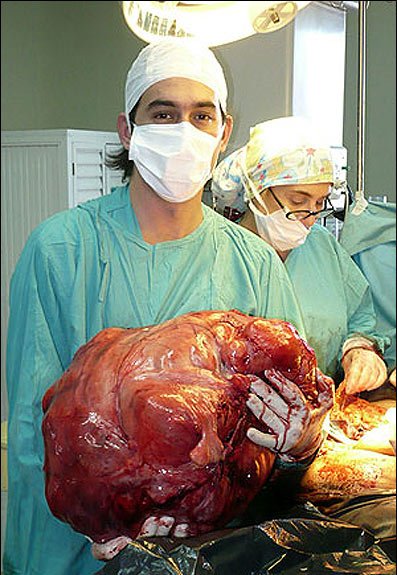 زنی که با دیدنش شاخ درمی‌آورید!!