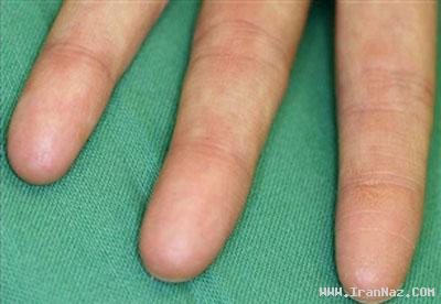 زمان و ساعت وبگردی؛ زن بسیار عجیبی که هیچ اثر انگشتی ندارد!! +عکس