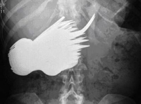 اتفاقی بسیار وحشتناک و عجیب برای یک زن آلمانی!! اتفاقی بسیار وحشتناک و عجیب برای یک زن آلمانی!!