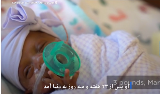 نوزادی به اندازه سیب رکورد گینس را شکست (عکس) نوزادی به اندازه سیب رکورد گینس را شکست (عکس)