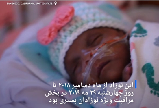 نوزادی به اندازه سیب رکورد گینس را شکست (عکس) نوزادی به اندازه سیب رکورد گینس را شکست (عکس)