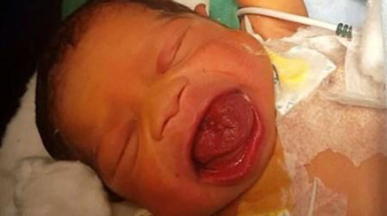 زبان این نوزاد دو برابر دهانش است + عکس زبان این نوزاد دو برابر دهانش است + عکس