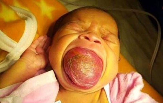 زبان این نوزاد دو برابر دهانش است + عکس زبان این نوزاد دو برابر دهانش است + عکس