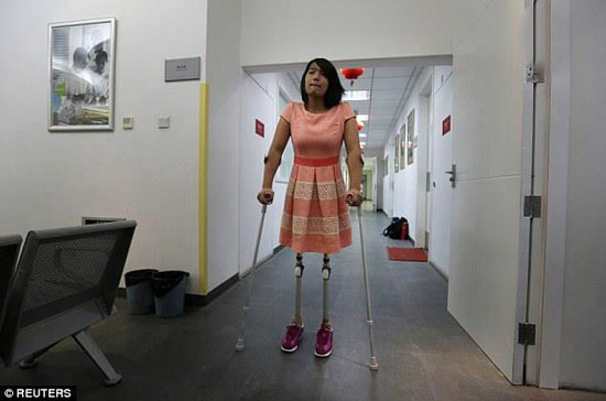 دختری که پاهایش یک توپ بسکتبال است + عکس دختری که پاهایش یک توپ بسکتبال است + عکس