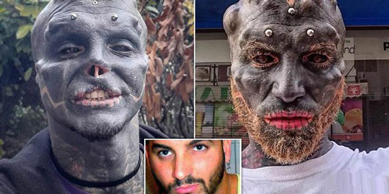 مردی که با بریدن گوش، دهان و بینی خودش را شبیه موجودات فضایی کرد + عکس 18+ مردی که با بریدن گوش، دهان و بینی خودش را شبیه موجودات فضایی کرد + عکس 18+