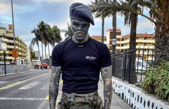 مردی که با بریدن گوش، دهان و بینی خودش را شبیه موجودات فضایی کرد + عکس 18+ مردی که با بریدن گوش، دهان و بینی خودش را شبیه موجودات فضایی کرد + عکس 18+