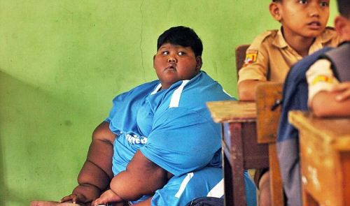 چاقی این پسر جوان و خطر ترکیدنش (عکس) چاقی این پسر جوان و خطر ترکیدنش (عکس)