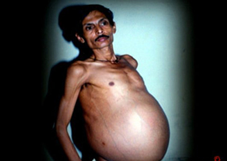 با عجیب و غریب ترین انسان های دنیا آشنا شوید (عکس) با عجیب و غریب ترین انسان های دنیا آشنا شوید (عکس)