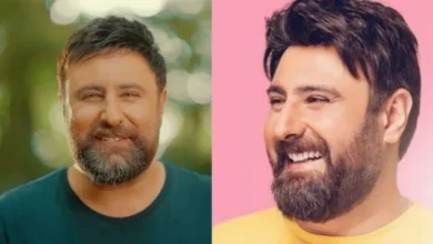 تاریخ وبگردی | چهره عجیب محمد علیزاده قبل از کاشت مو