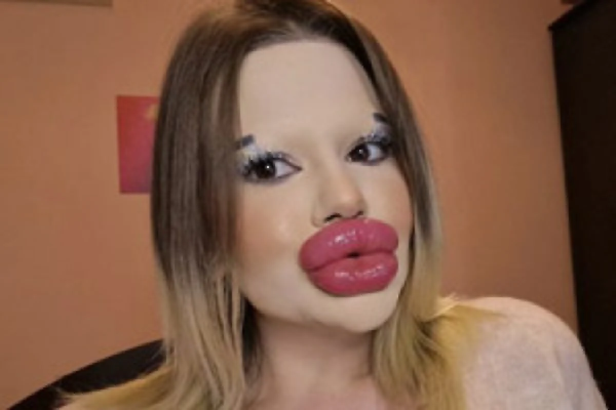 نگاه روز | این زن بزرگترین لب و استخوان گونه جهان را دارد