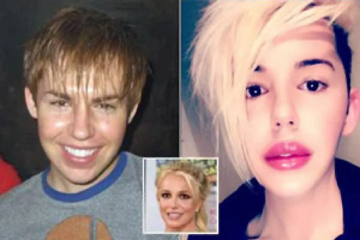 نگاه روز |این پسر با 100 عمل زیبایی خودش را شبیه بریتنی اسپیرز کرد