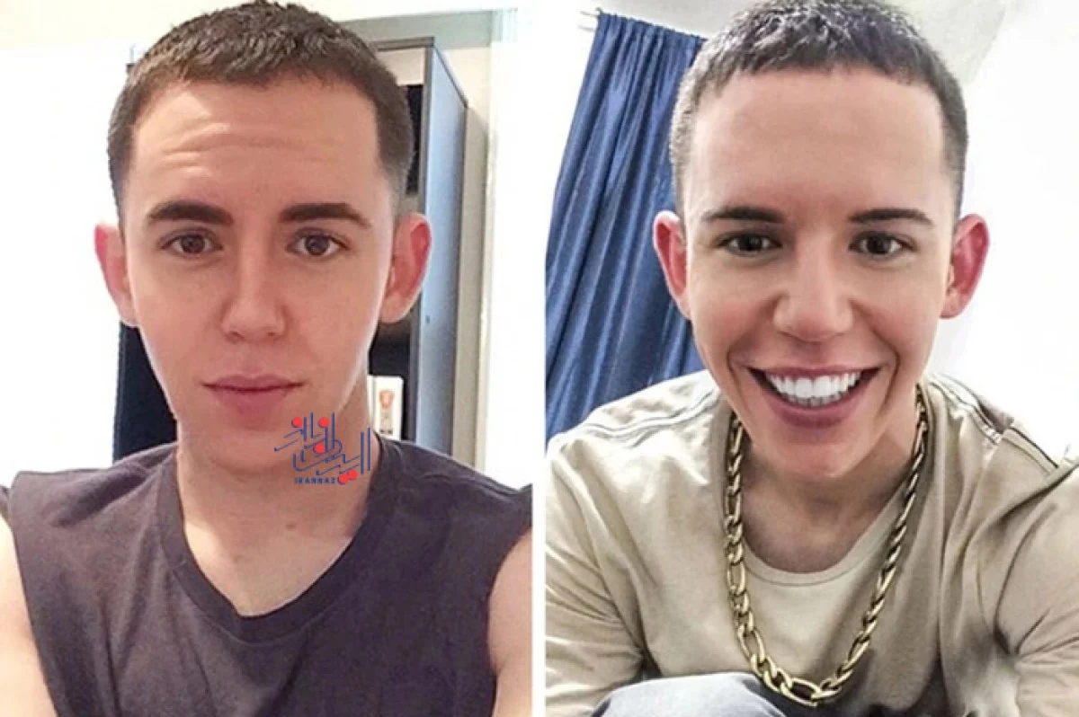 او تغییر ظاهری خود را در سال های نوجوانی آغاز کرد