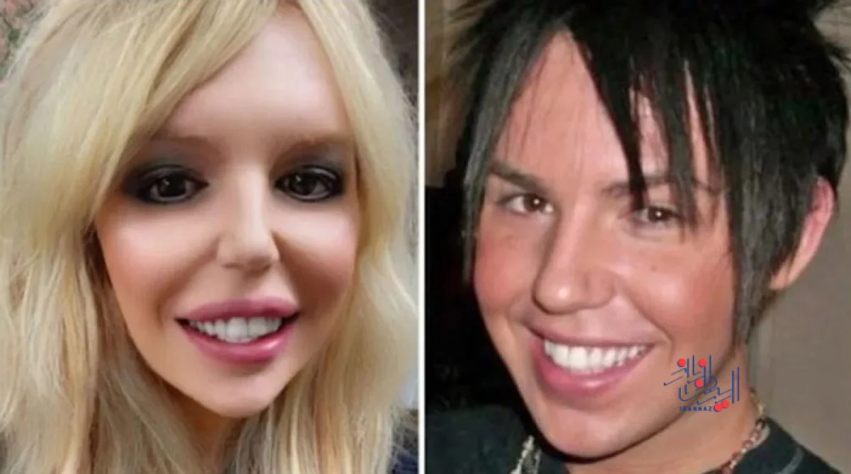 عمل بینی به عنوان هدیه تولد 21 سالگی