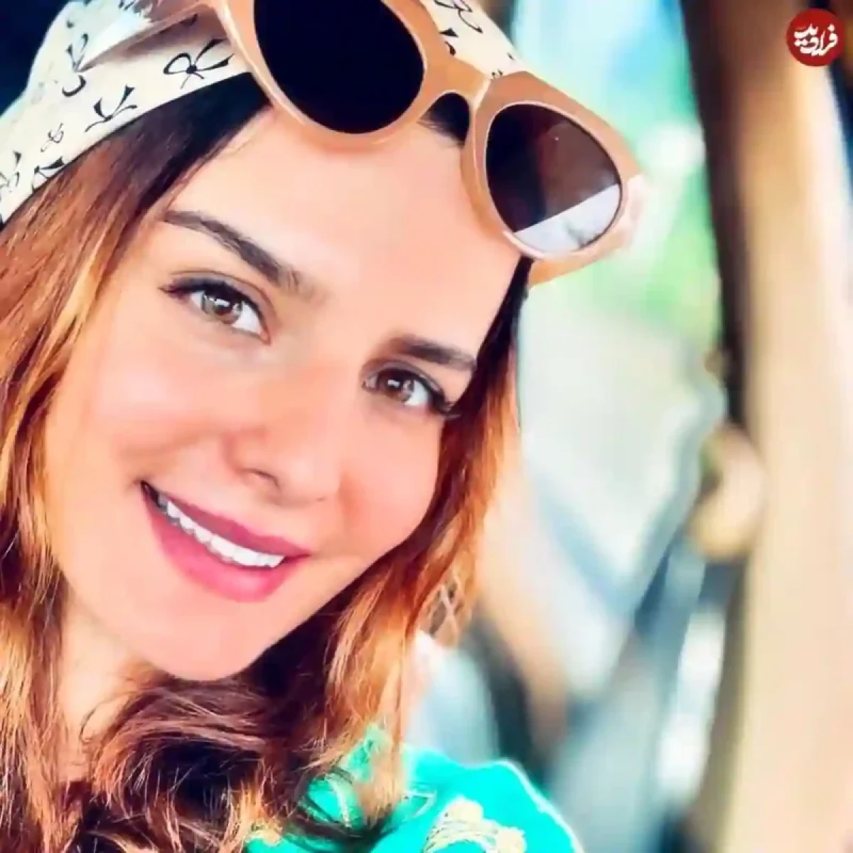 تغییر چهره جذاب و خاص غزاله اکرمی در ۲۶ سالگی 6149984