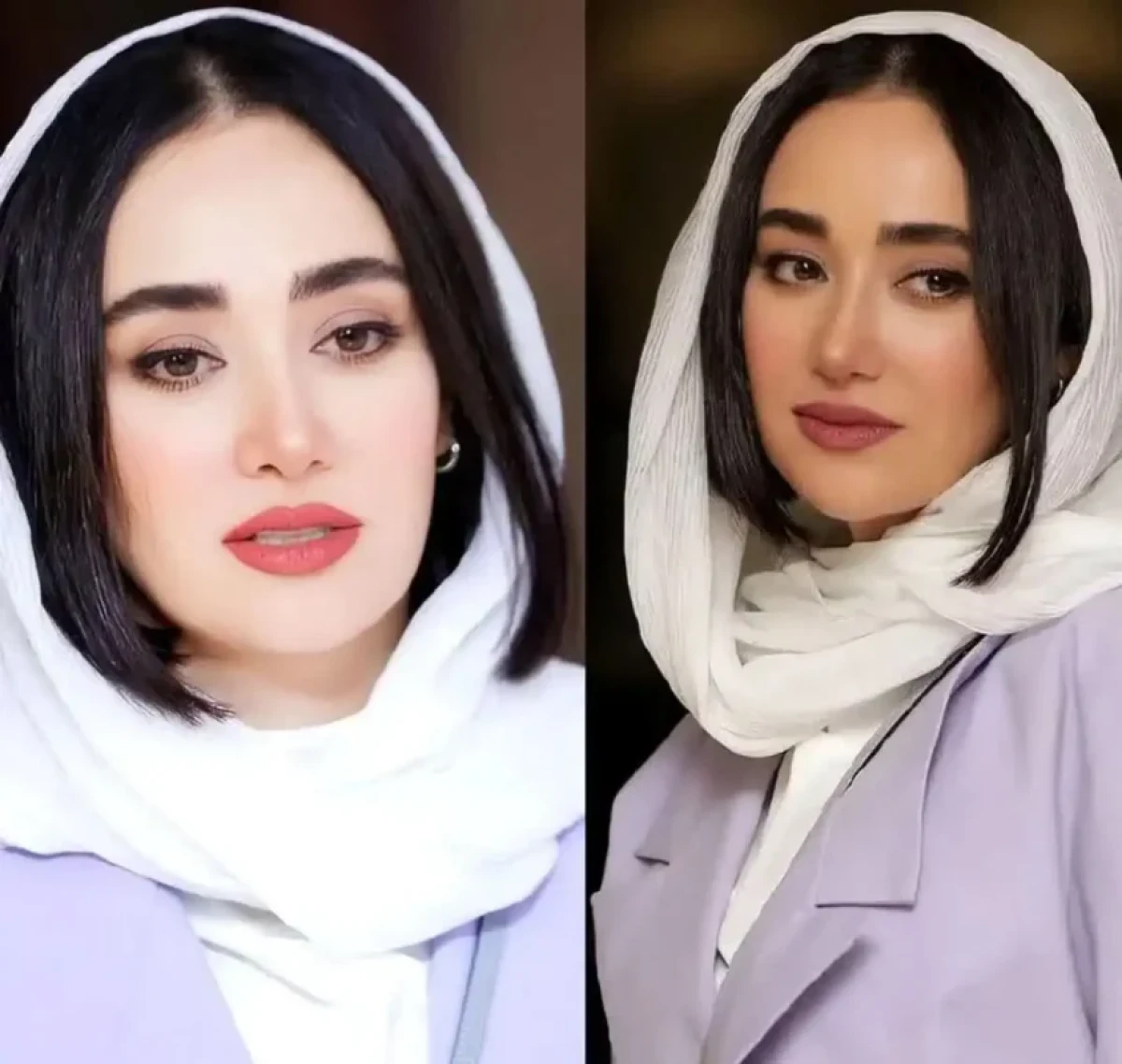 تغییر چهره بهاره افشاری بازیگر نقش اول سریال «او یک فرشته بود» را می بینید IMG 20241122 094157 234 1