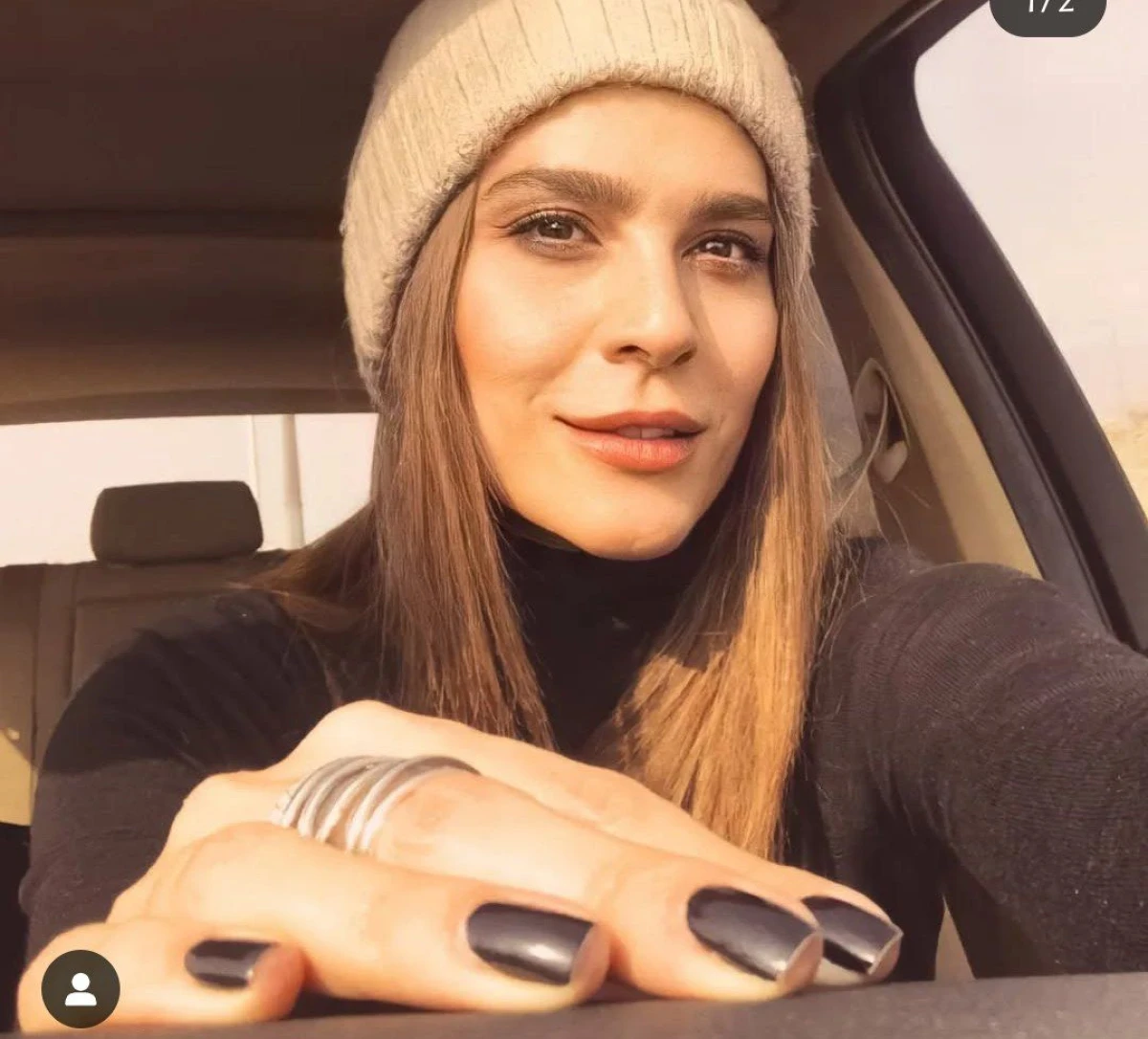 تصاویر دیده نشده | تغییر چهره خانم بازیگر سحر دولتشاهی 